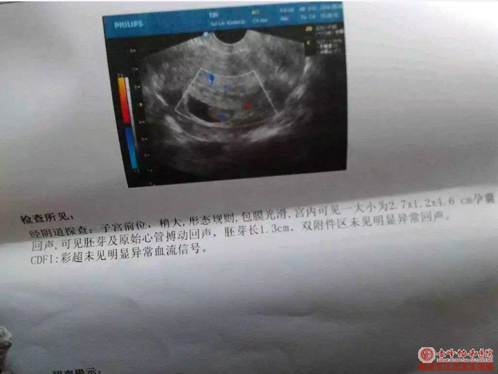 宁德原想做个人流,缘何让我B超检查